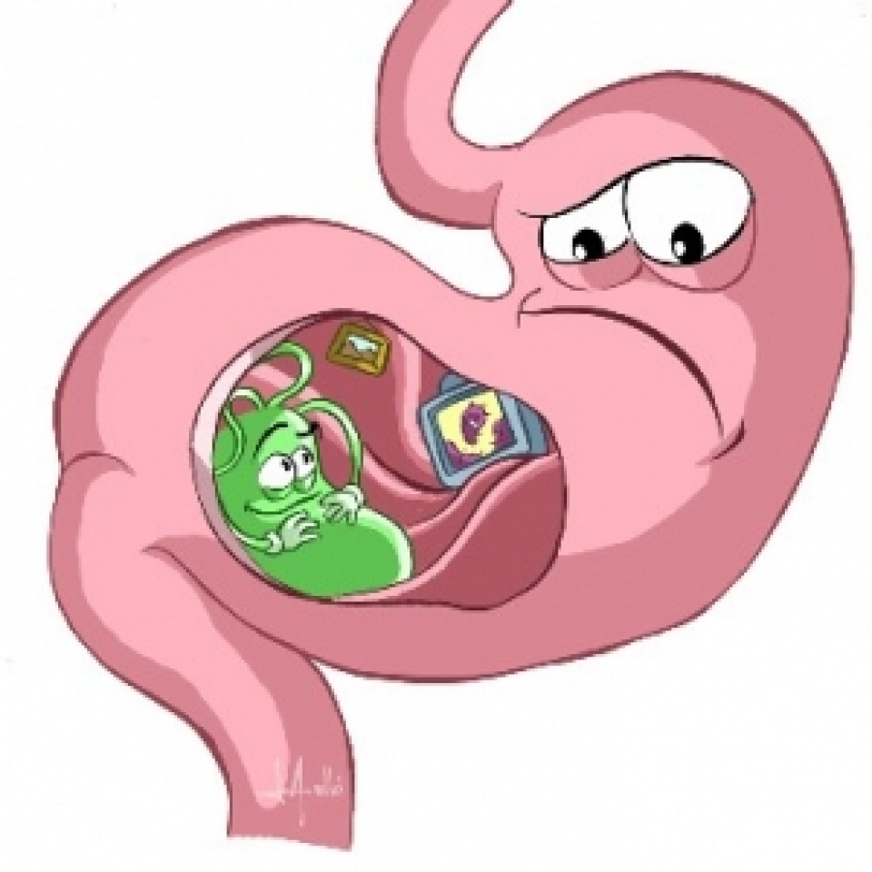 Colon irritabile